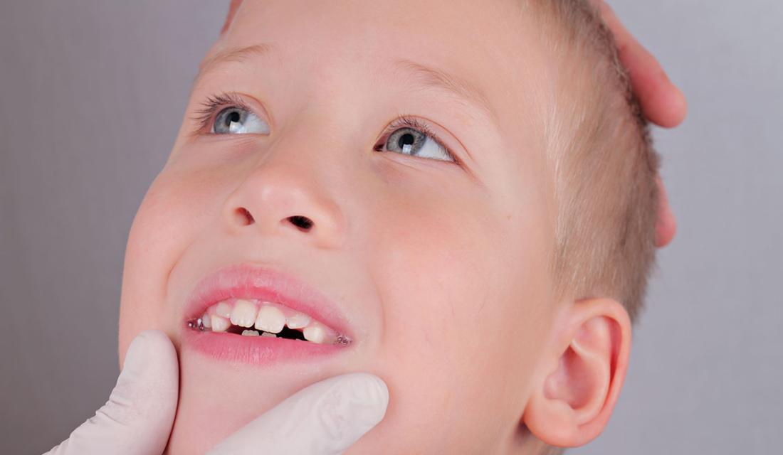Kinderzähne